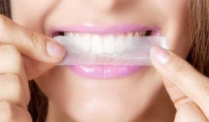 Teeth Whitening Guide
